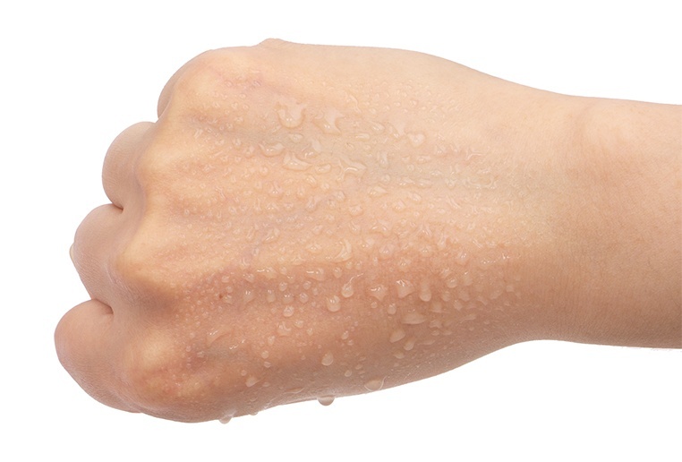 thumb_image